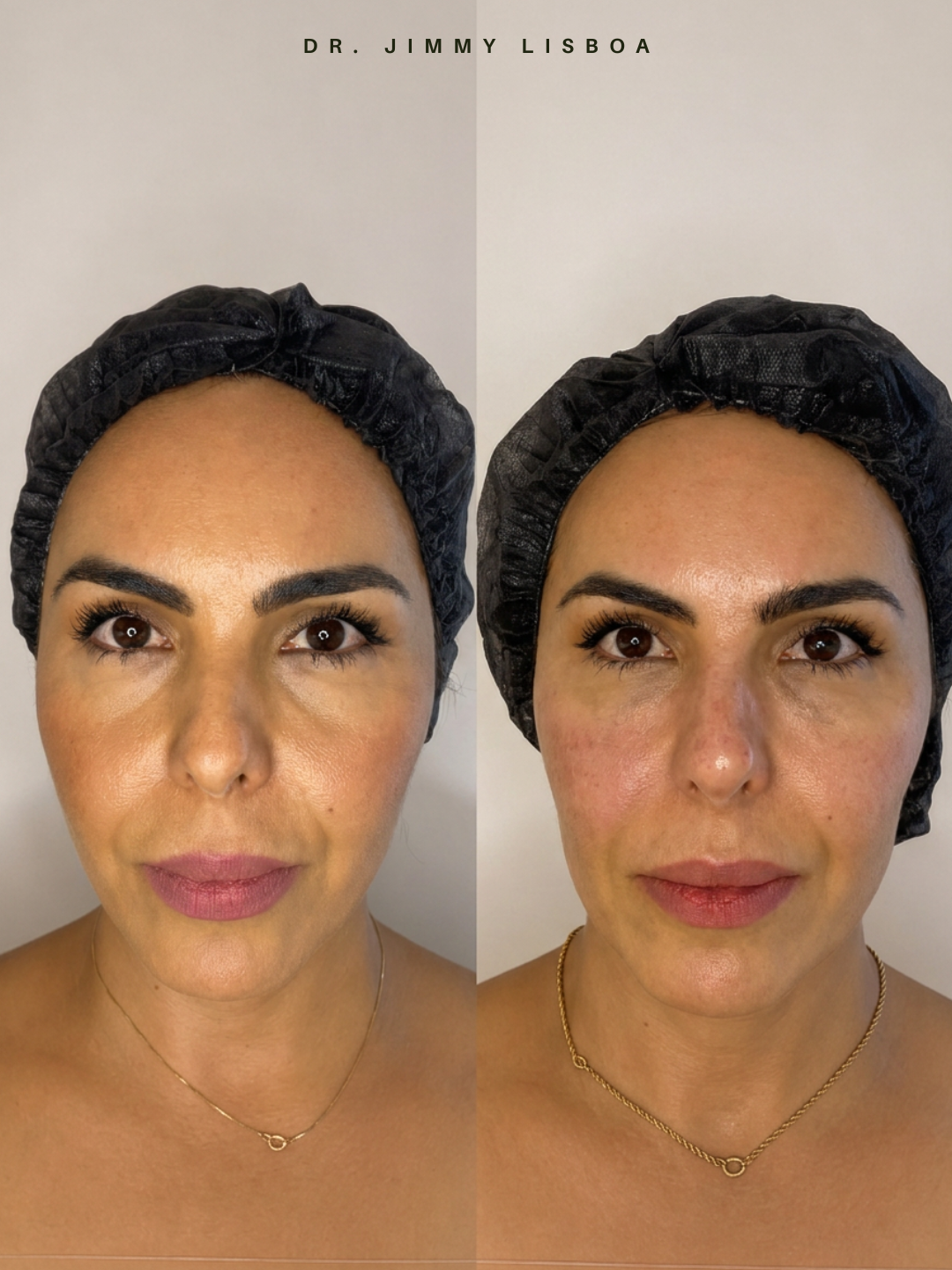 Resultado antes e depois 3